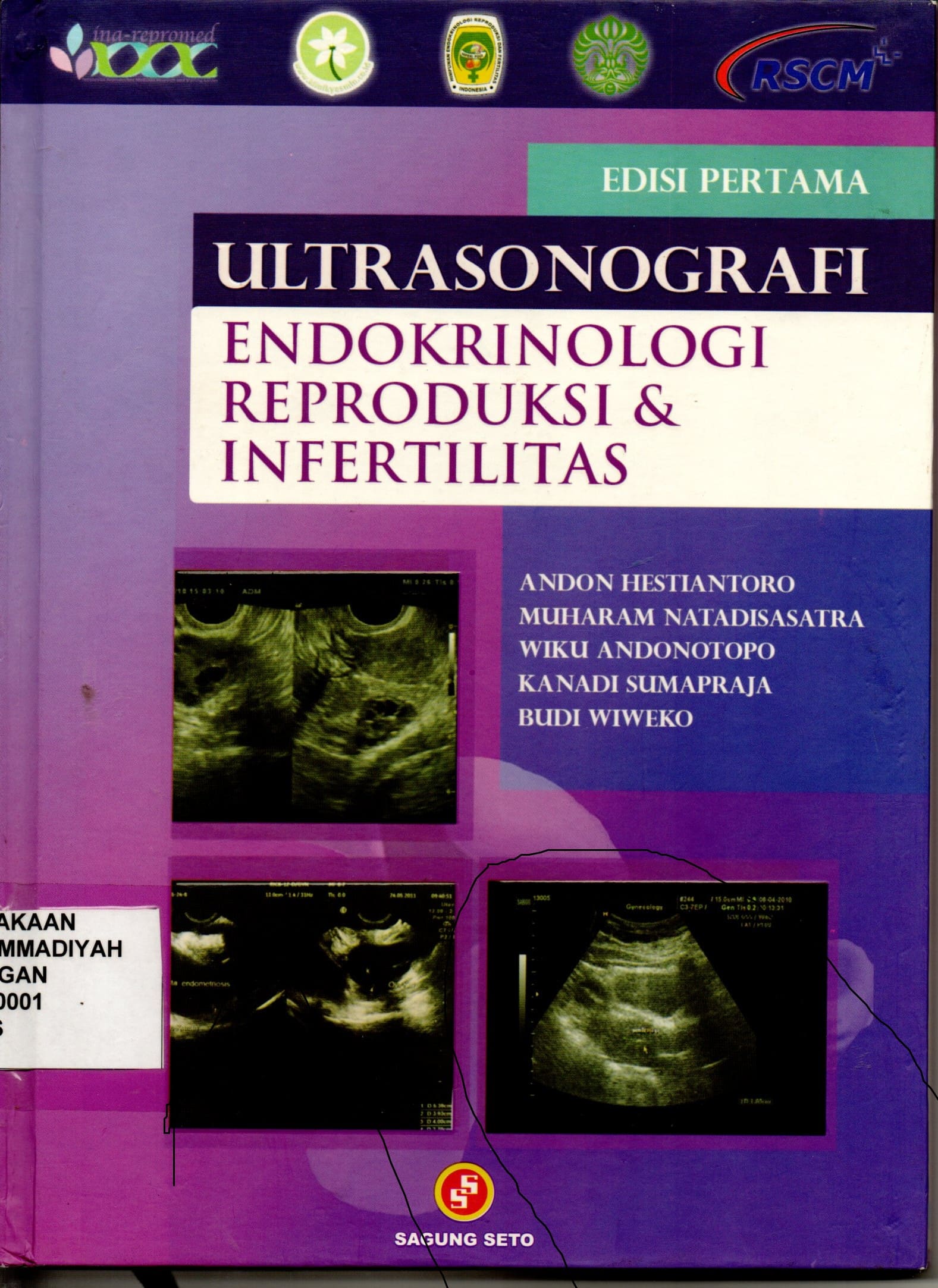 Ultrasonografi Endokrinologi Reproduksi & Infertilitas