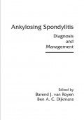 Ankylosing Spondylitis Diagnosis And Management
